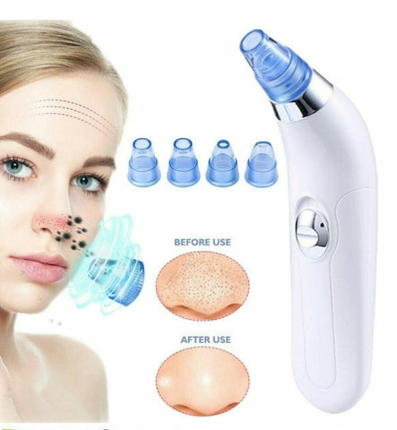 Facial Pore Cleaner